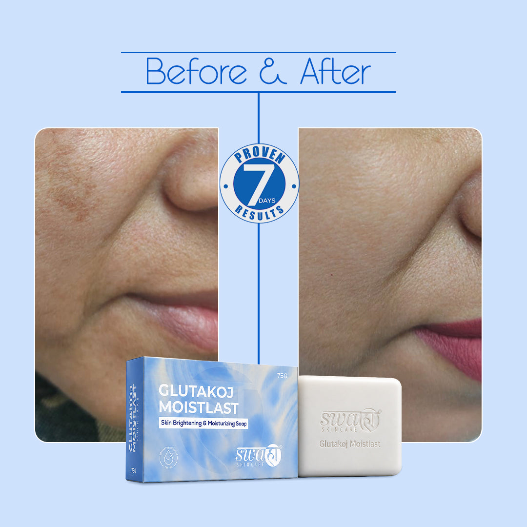 Glutakoj Moistlast Soap
