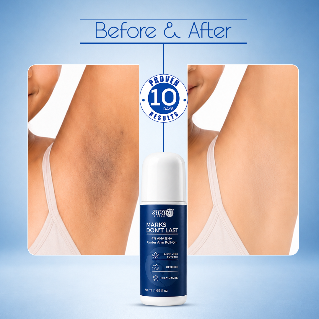 Marks Don't Last 4% AHA + BHA Underarm Roll-On – 50 ml