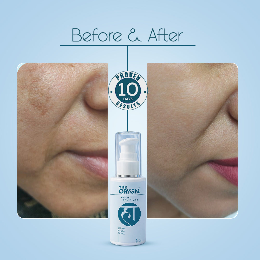 THE ORYGN Marks Don't Last Face Serum