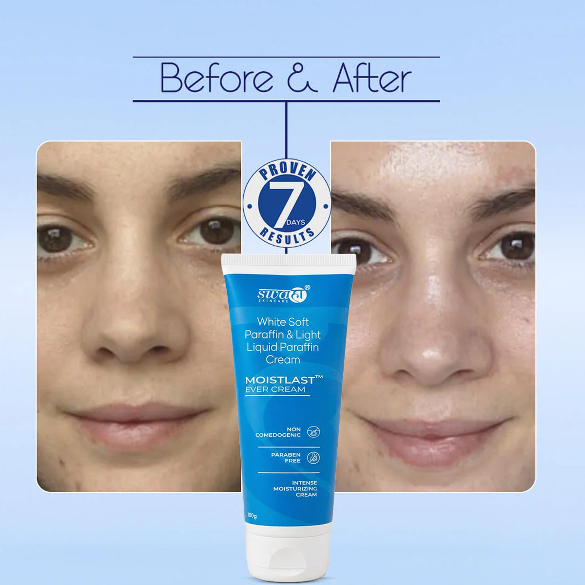 Moistlast Ever Cream Intense Moisturizer