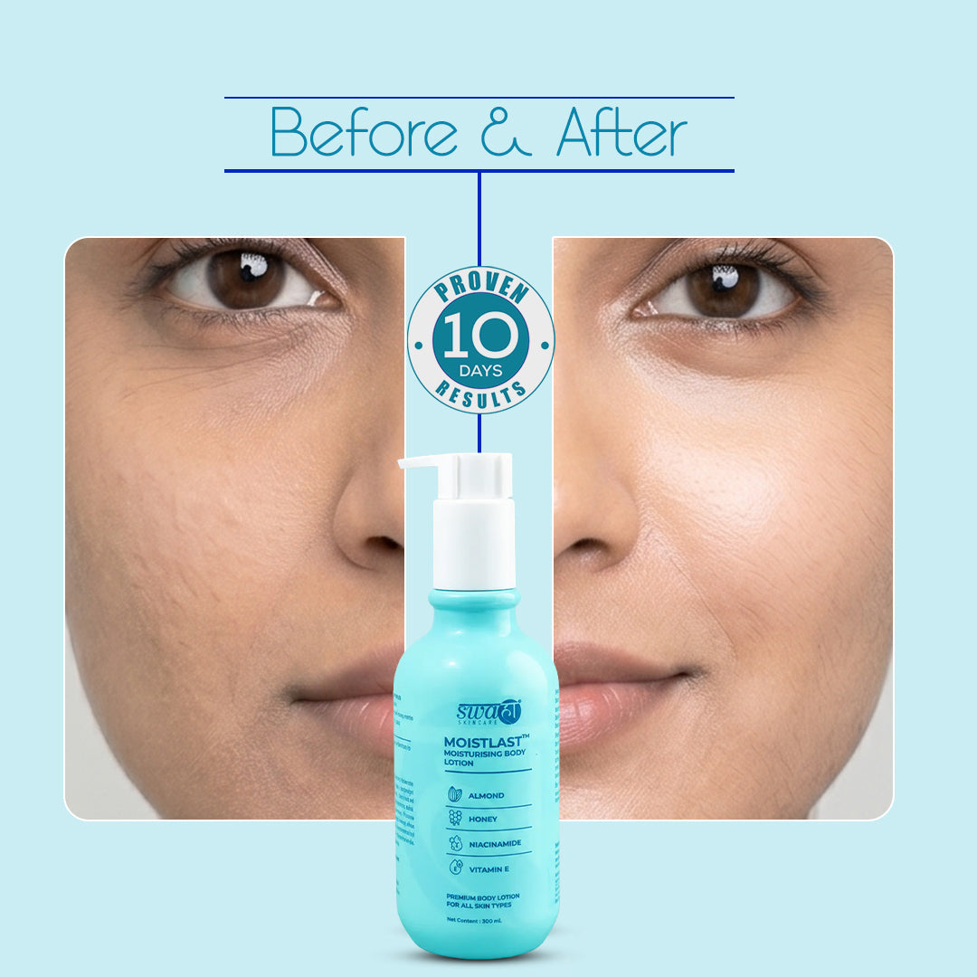 Moistlast Moisturising Body Lotion