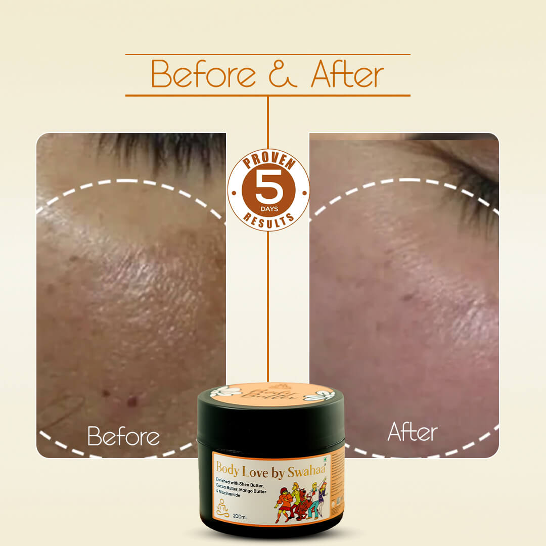 Body Butter – Moisturizing Cream