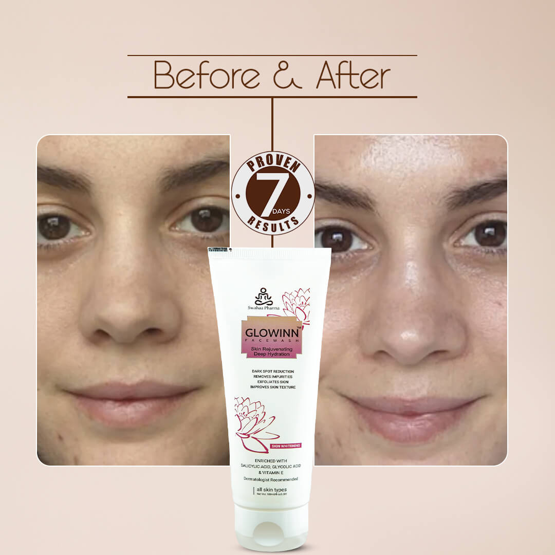 Glowinn Facewash – Skin Rejuvenating & Deep Hydration