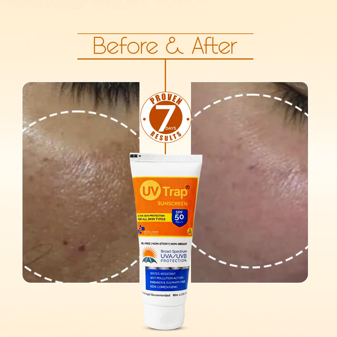 UV Trap Sunscreen SPF 50 PA+++
